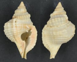 Distorsio reticularis