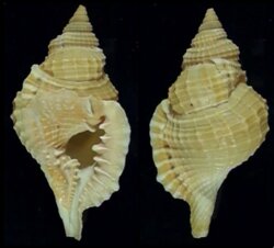 Distorsio reticularis