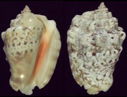 Lentigo lentiginosus