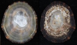 Patella vulgata
