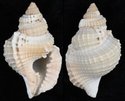 Distorsio reticularis