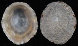 Patella vulgata