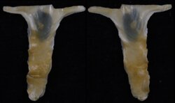 Malleus albus